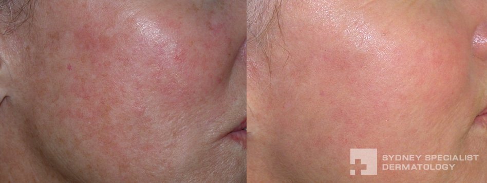 Florida Skin Cancer And Dermatology Specialist