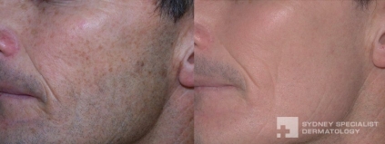 Click on image to enlarge