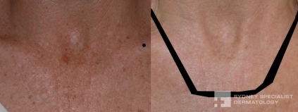 Click on image to enlarge